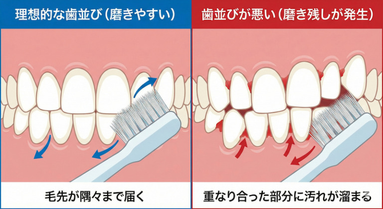 歯並びは「一生モノの財産」！健口を守るために大切な理由